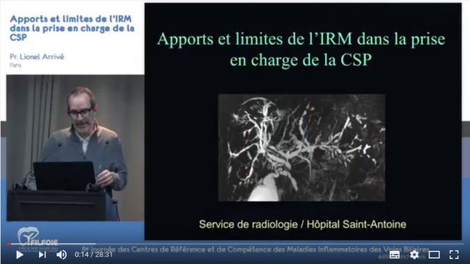 Vidéo Lionel Arrivé